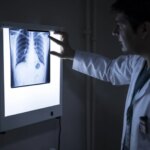 medico-mirando-una-radiografia.jpeg