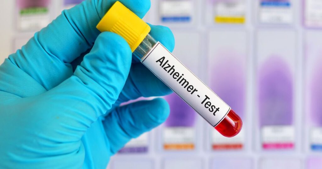 0_Blood-sample-for-Alzheimer-test.jpg