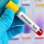 0_Blood-sample-for-Alzheimer-test.jpg