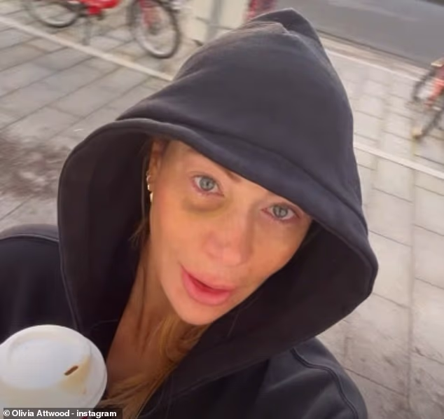 105598599-15473029-Olivia_Attwood_34_has_left_her_fans_concerned_as_she_revealed_sh-m-6_176867328263.avif