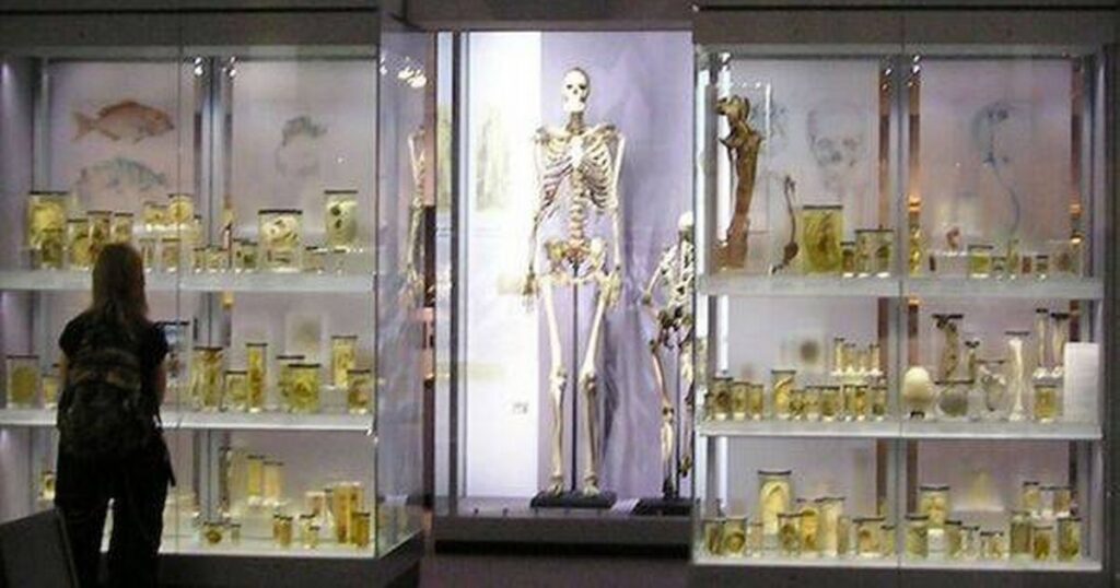 2_Byrnes-skeleton-in-the-Hunterian-Museum.jpg