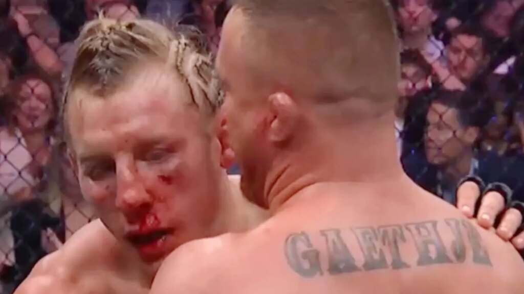 ah-OFF-PLATFORM-gaethje-face.jpg
