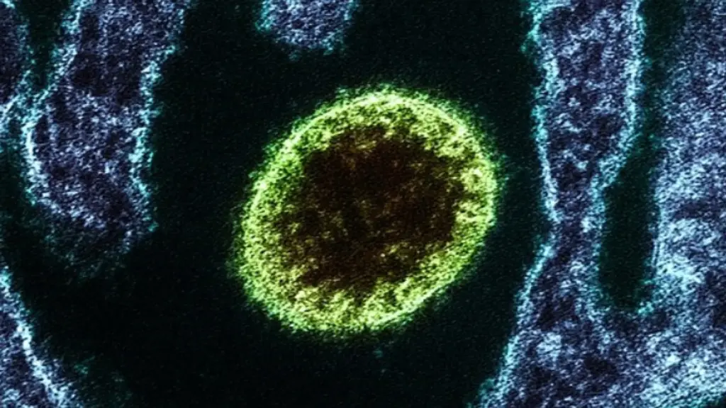una-joven-muere-y-otra-esta-en-la-uci-por-el-virus-nipah-vigilado-por-la-oms-como-posible-proxima-pa.webp